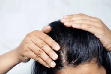 Biotin Supplements for Hair Growth | Skintellect Daily