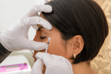 alternatives for botox